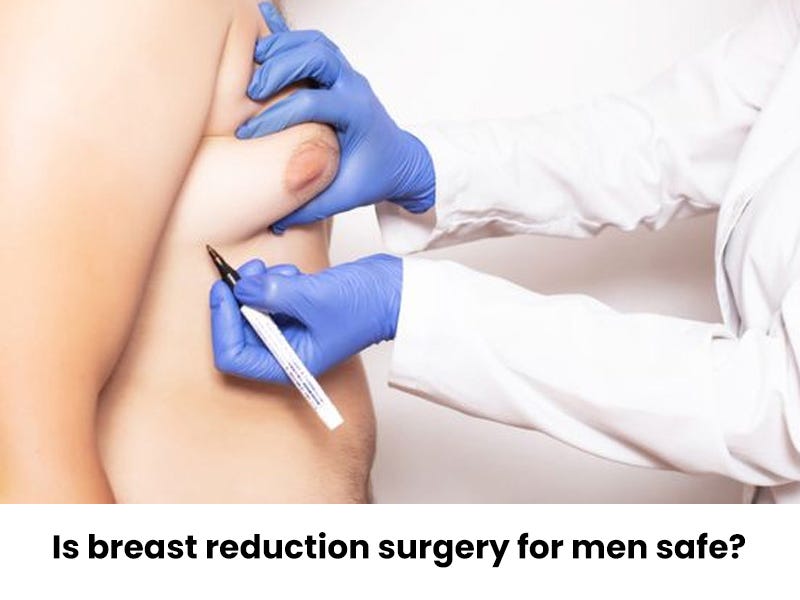 Breast Reduction After Pregnancy: What You Need To Know – Synergy Plastic  Surgery