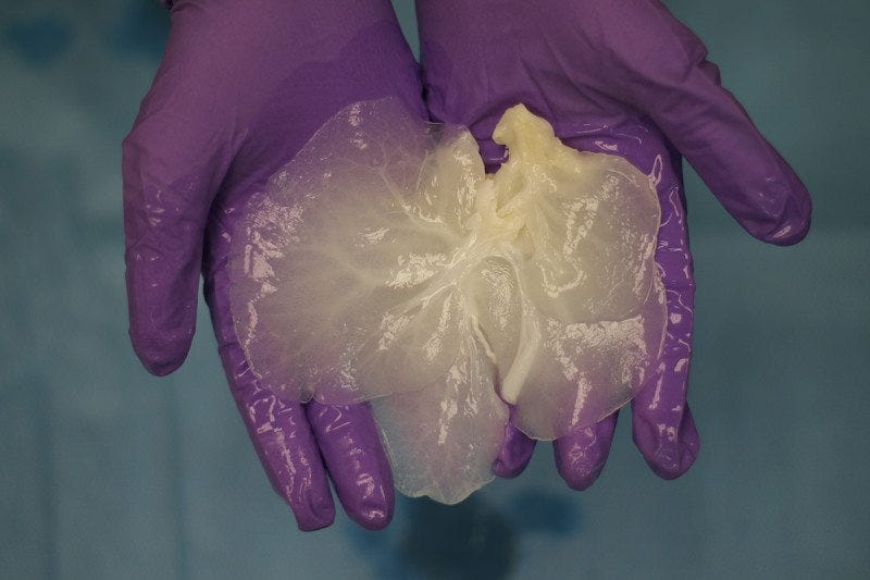 Organi da trapianto creati sciogliendo e ricostruendo fegati di maiale