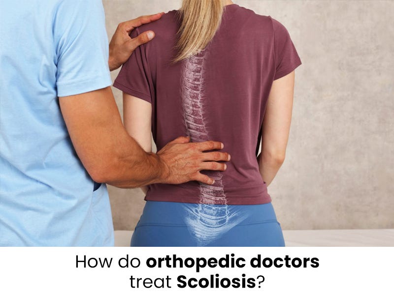 How do orthopedic doctors treat Scoliosis? by Apurba Digitalgoogly