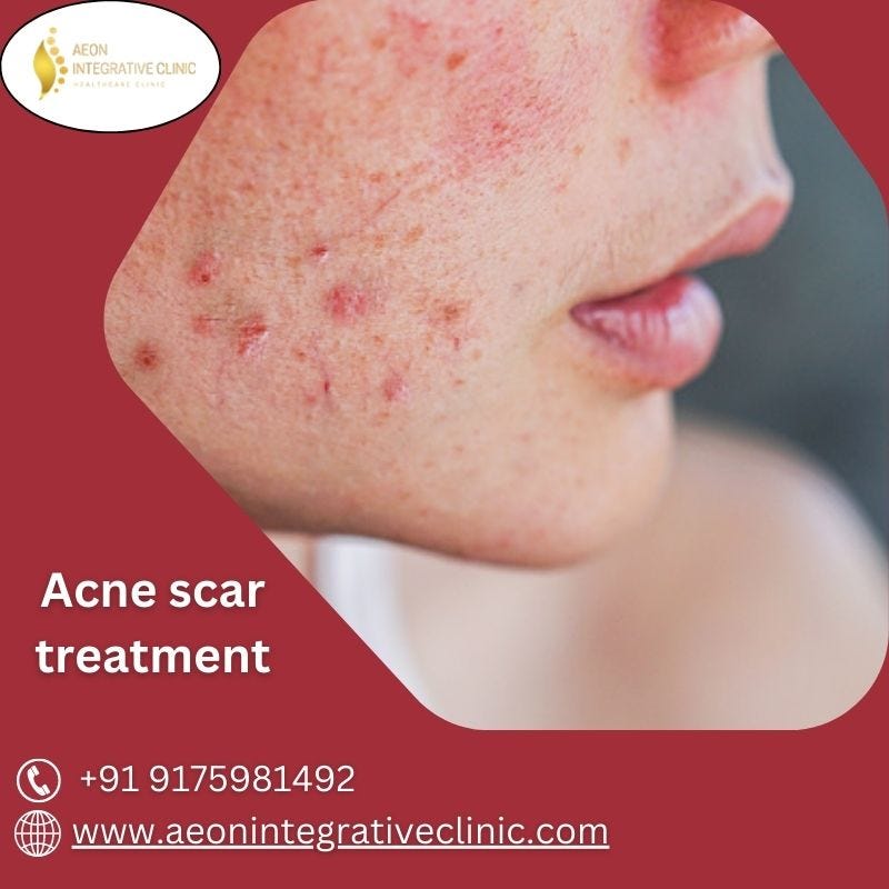 Scars Fading Away Journey to Acne Scar Recovery by