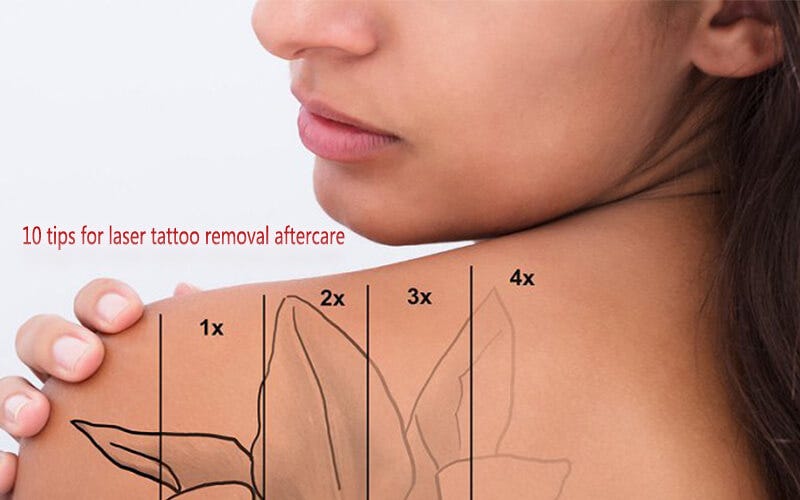 Saying Goodbye to Regrets: The Ultimate Guide to Laser Tattoo Removal!” |  by Tayybakanwalkhan | Jul, 2023 | Medium