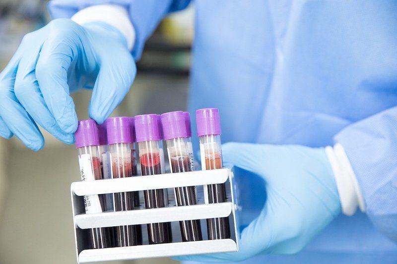 Healthcare made easier at your doorstep 🏠🩸
 RPCS provides reliable home blood sample collection…