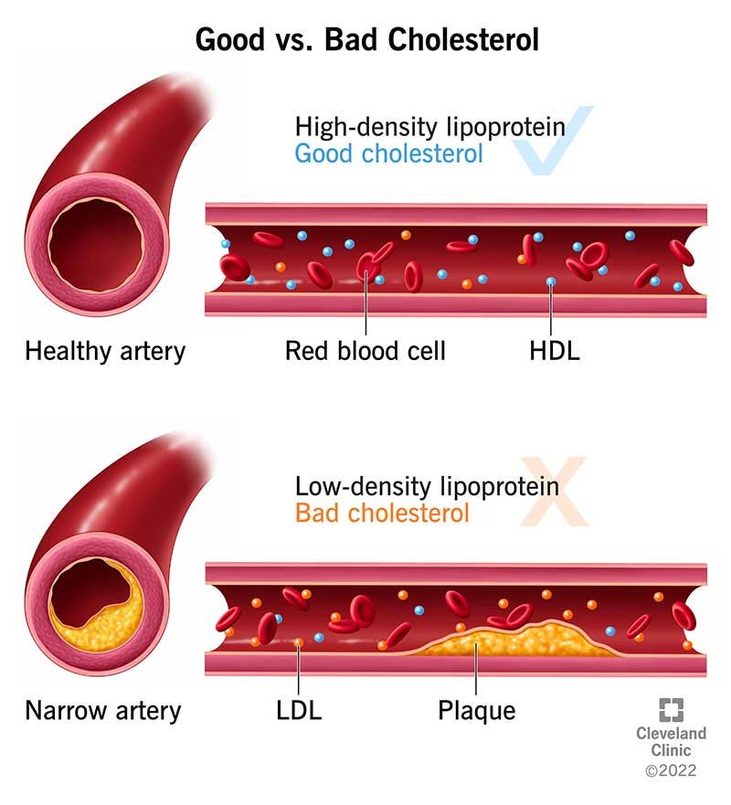 Understanding Cholesterol in Children A Guide for Parents by