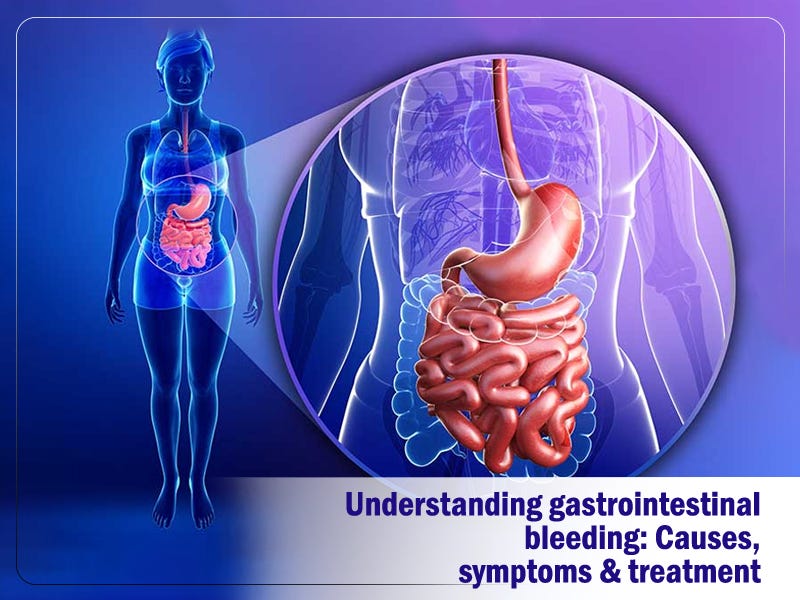 Understanding gastrointestinal bleeding Causes, symptoms & treatment