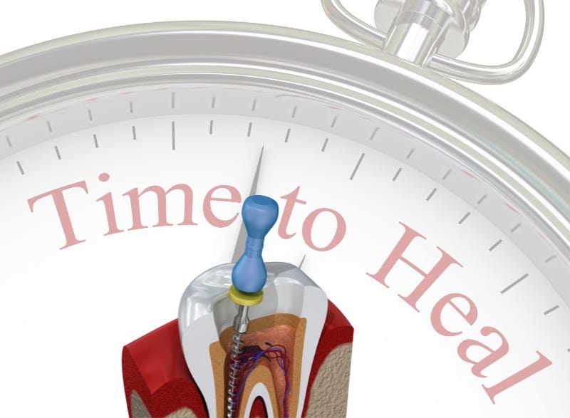 How Long Does A Root Canal Take To Heal? Medium