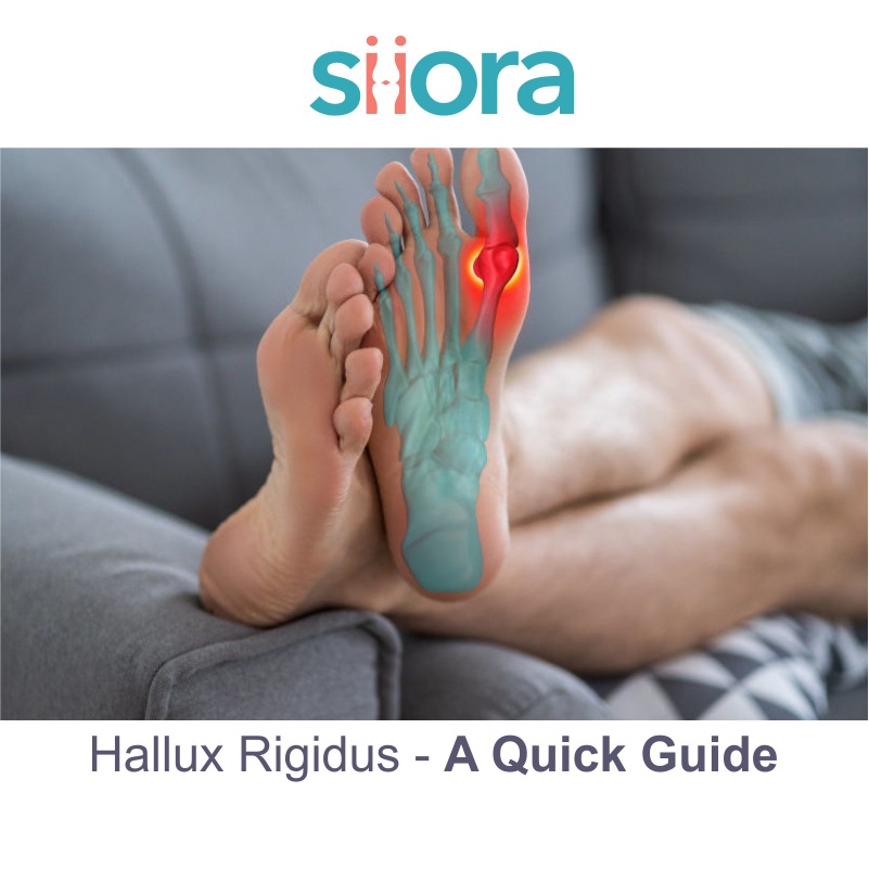 Hallux Rigidus — A Quick Guide Siiora Surgical Medium