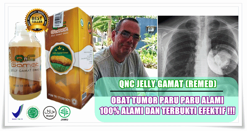 Obat Tumor Paru Paru Alami 100% Alami Dan Terbukti Efektif