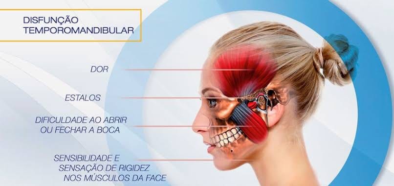 Maxilar estalando: 6 causas comuns (e o que fazer) - Tua Saúde