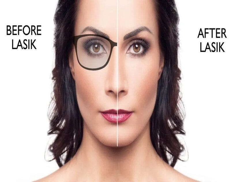 Navigating Lasik Surgery Costs in Mumbai Insights with Dr. Sonia