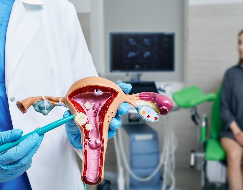 Fibroid Treatment Near Me Expert Care for Uterine Fibroids