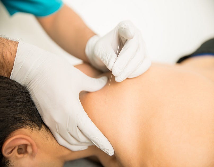Why More Individuals Are Turning to Acupuncture Treatment In Finch for Natural Recovery and Pain…