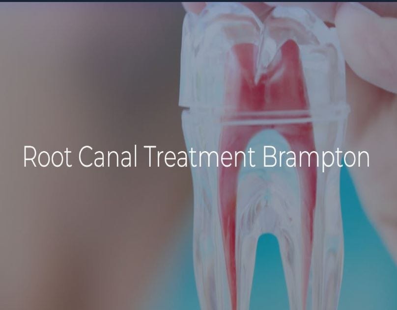 Root Canal Treatment Brampton Beaumaris Dental Care Medium Root Canal Treatment Brampton Beaumaris Dental Care Medium