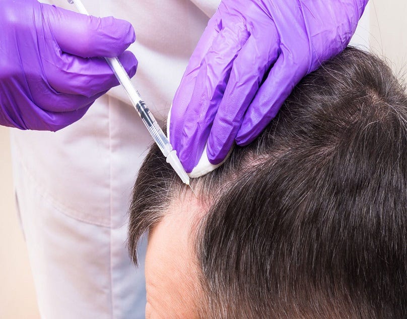 Transform Your Hair and Scalp Health with a Top Trichologist in Los