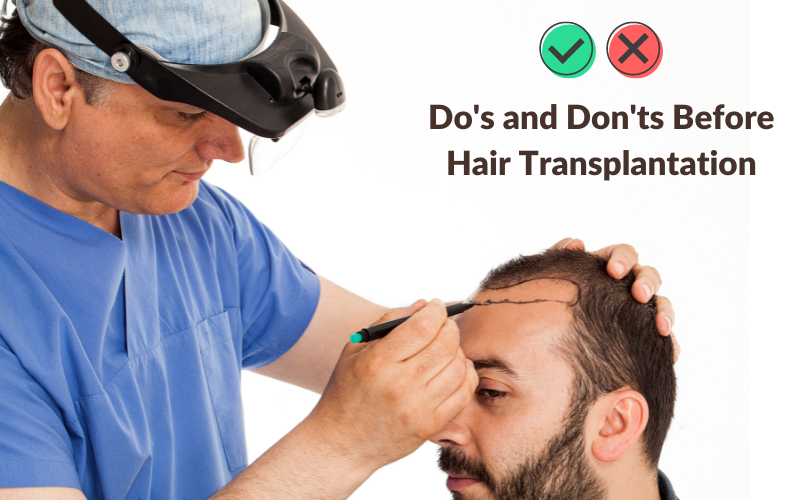 Do’s and Don’ts Before Hair Transplantation Vivaaestheticclinic Medium
