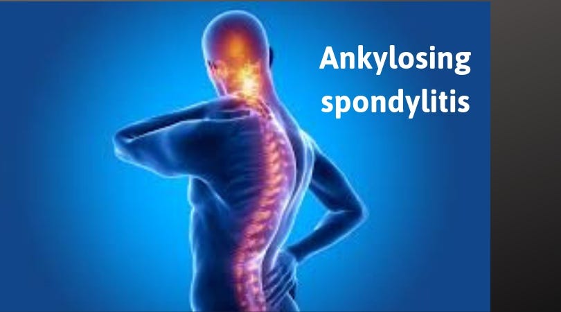 Things You Should Know About Ankylosing spondylitis: Symptoms ...