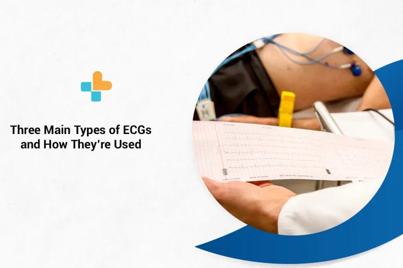 Three Main Types of ECGs and How They’re Used by Ayu Health Hospitals