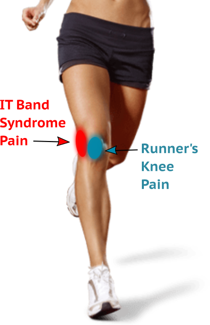 Runners Knee (also known as) ITB Syndrome - Do You Have It and How Do You  Treat It? - Pea Green Physio
