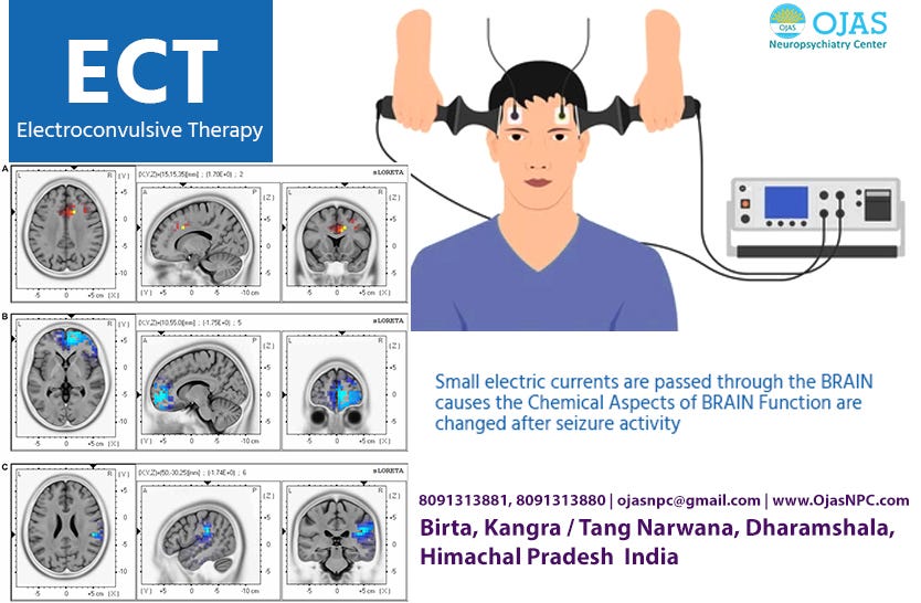 Electroconvulsive Therapy (ECT)