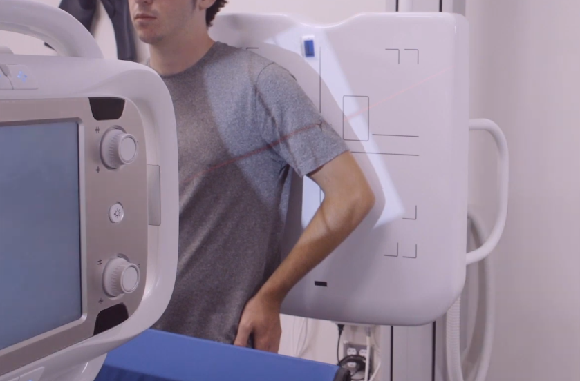 Optimal Lateral Humerus Xray Positioning A Comprehensive Guide for Radiographers by Dipen