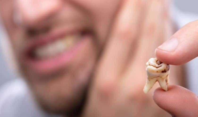 Tooth Fillings: A Simple Solution for Tooth Decay