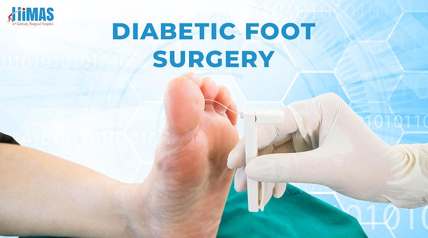 Best Diabetic Foot Surgery