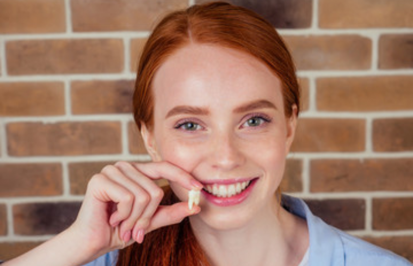 Tooth Extractions When is it done, and what to expect? by Mendota