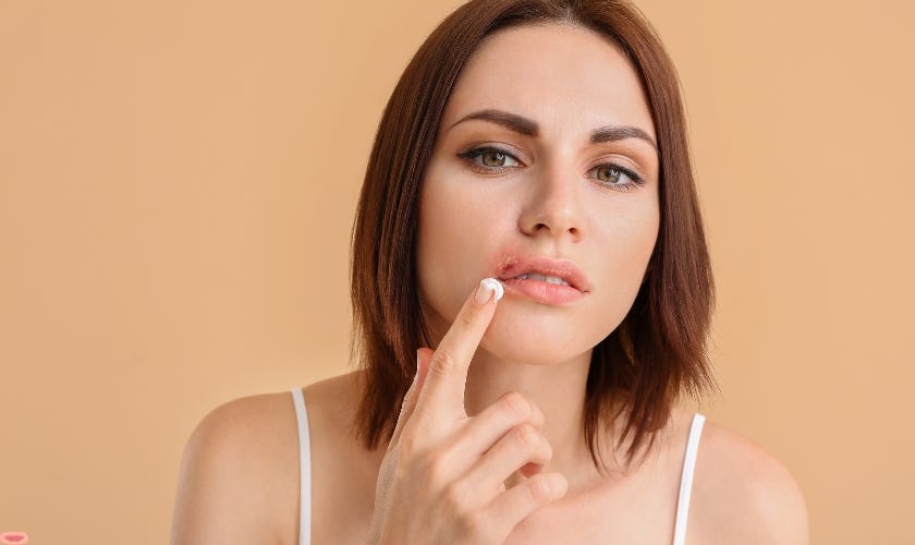 Are all cold sores herpes? Exploring the Relationship by Woolaver Orthodontics May, 2024