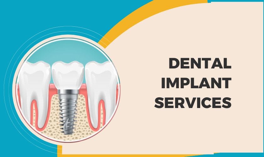 dental implants ashburn va