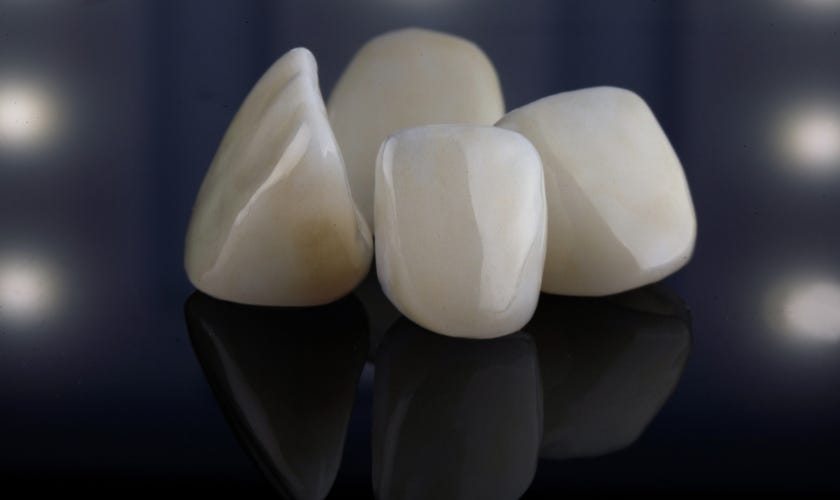 Managing Extreme Pain After Getting Dental Veneers Floss Dental