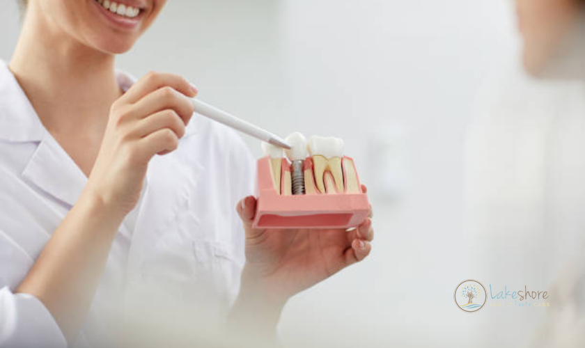 How To Mentally Prepare For Dental Implant Surgery by Lakeshore Family Dental Care Ryan T