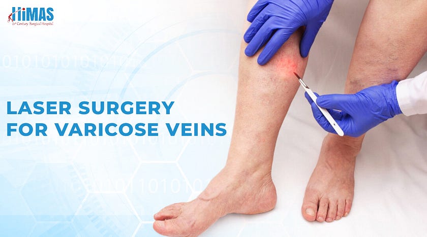 Best Laser Surgery for Varicose Veins