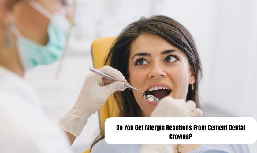 Do You Get Allergic Reactions From Cement Dental Crowns? by MK Dental