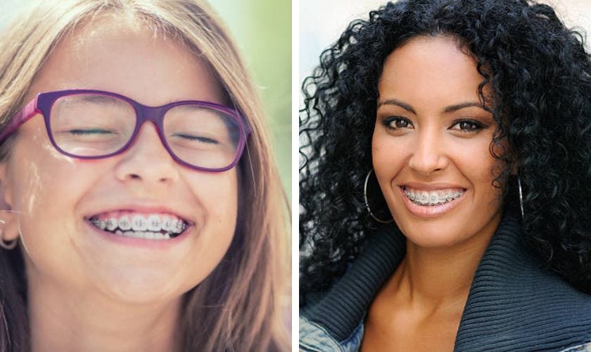 3 Difference Between Adult and Child Braces by Lake Ridge