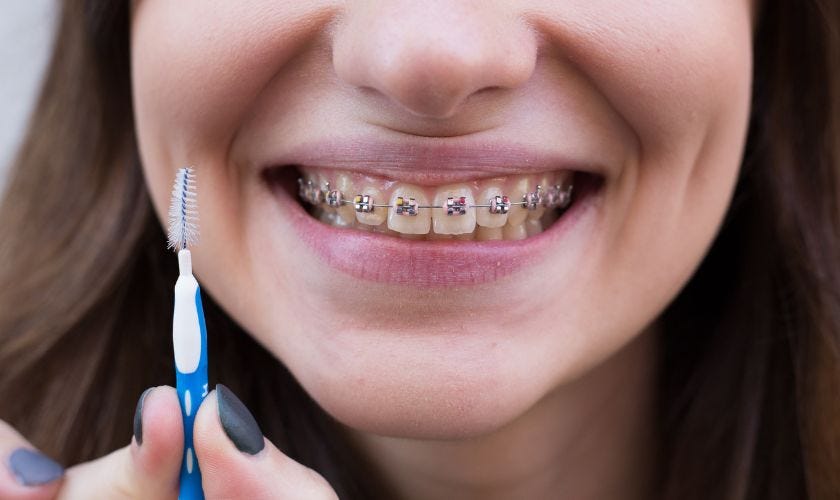 how-to-whiten-teeth-while-wearing-braces-medium