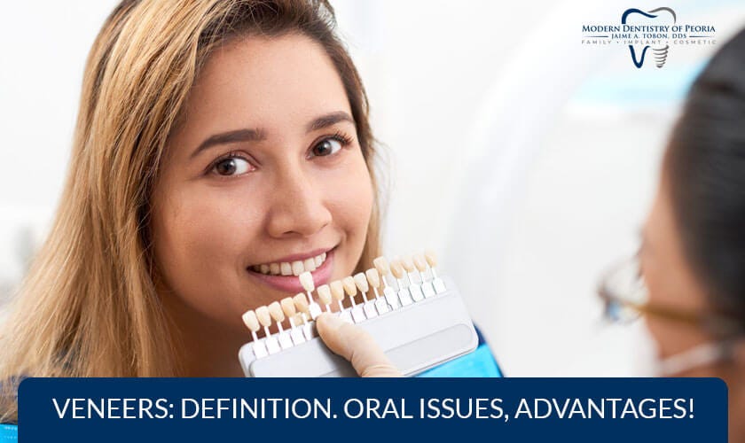 Veneers Definition. Oral Issues, Advantages! by Moderndentistryofpeoriaaz Medium