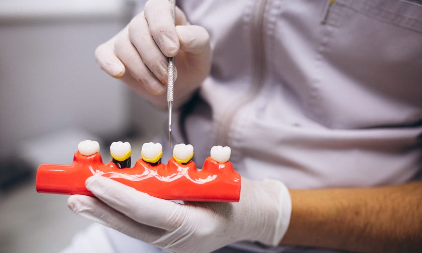 How Much Do Dental Crowns Cost?. Are you considering getting dental