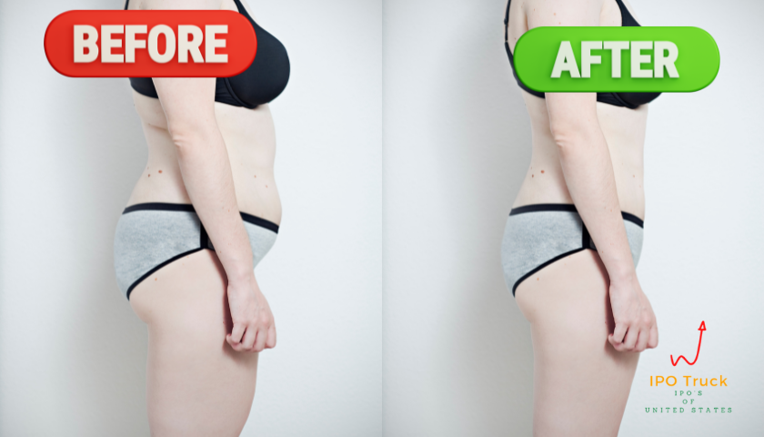 How much does AirSculpt lipo cost? Airsculpt pricing?