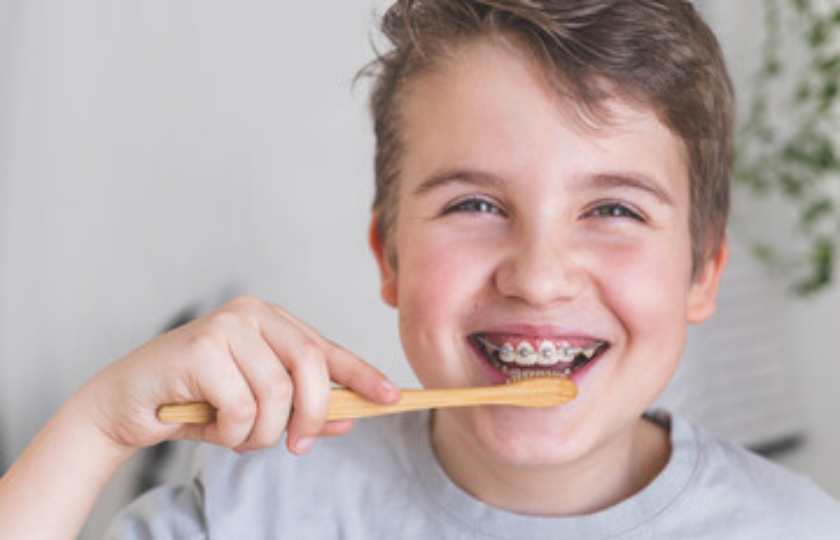 How Often Should I Brush My Teeth When Wearing Braces? Medium