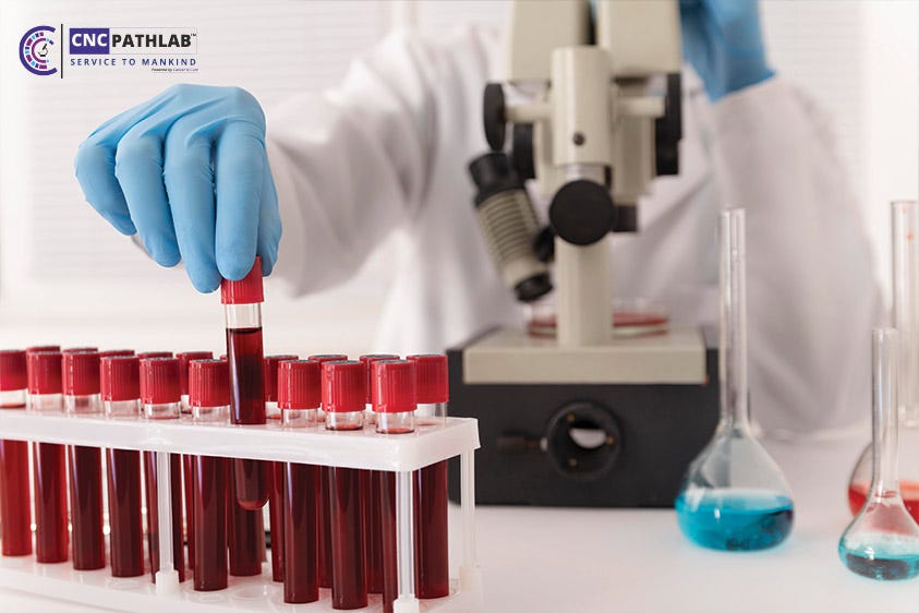 CNC Pathlab Offers Blood Sample Collection from Home by CNC Path Lab