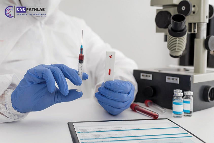 Blood Test Home Collection Near Me By CNC Path Lab Jul 2023 Medium blood-test-home-collection-near-me-by-cnc-path-lab-jul-2023-medium