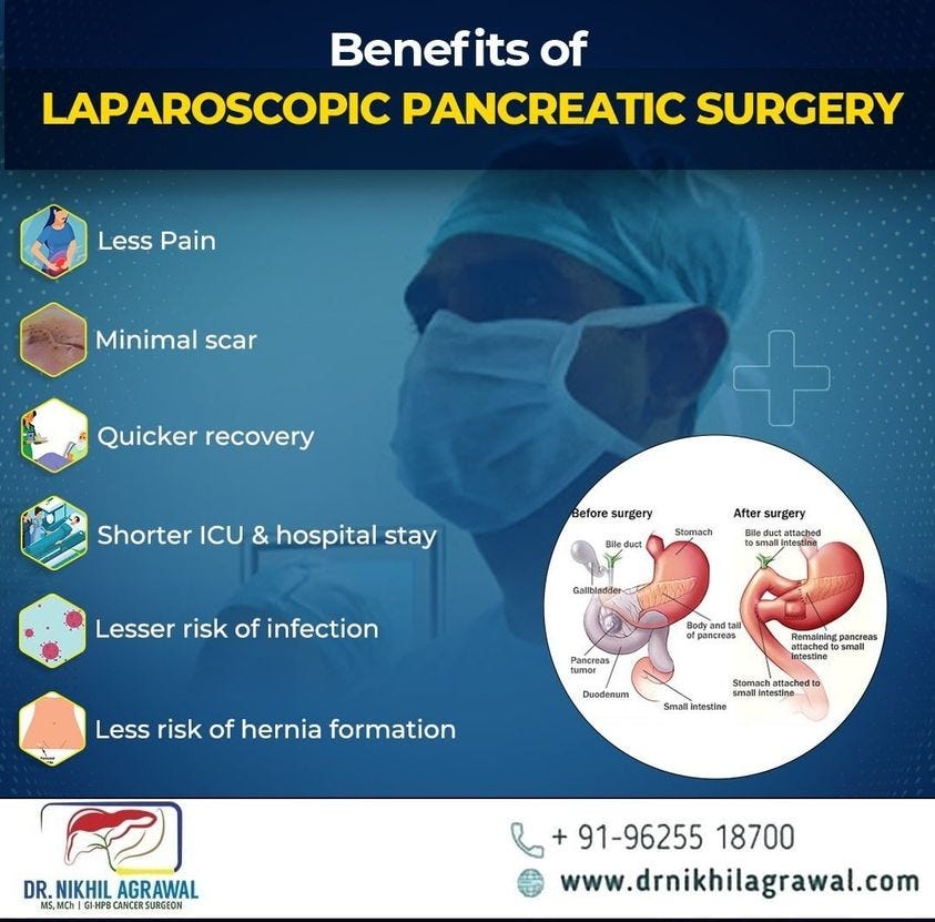 Best Pancreas Surgeon in Delhi ncr Dr Nikhil Agrawal is one of the Best Pancreas Surgeon in