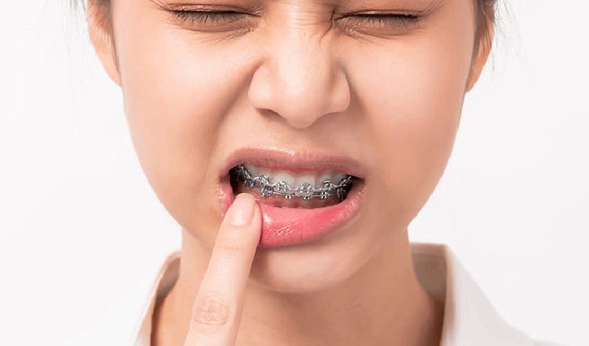 Essential Tips for Choosing the Right Orthodontist in Bowling Green
