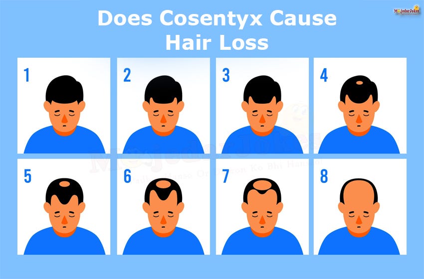 Cosentyx Side Effects : Does Cosentyx Cause Hair Loss - Majedarjokes