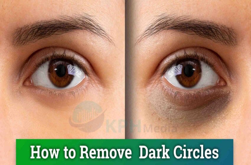 How to Remove Dark Circle some home remedies can assist you to get rid