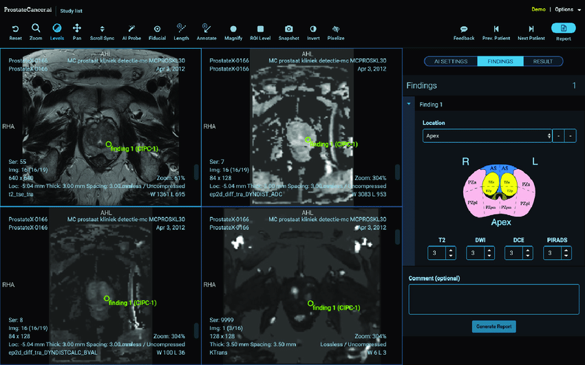 How the FDA Could Adapt to AI Learning in Medical Device