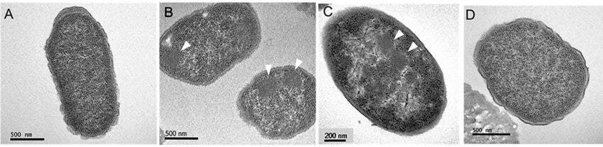 Electron microscopy of E. coli CFT073. Credit