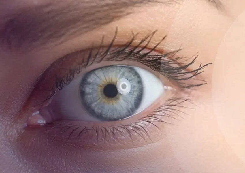 Eye Color Change Laser Surgery Cost Murat Kanbur