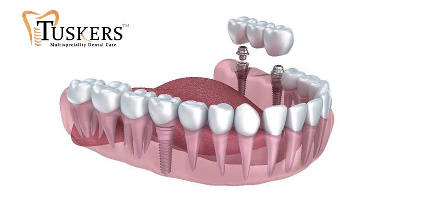 Healthy Smiles Begin With Trusted Hands