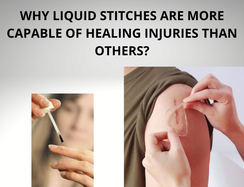 Why Liquid Stitches Are More Capable Of Healing Injuries Than