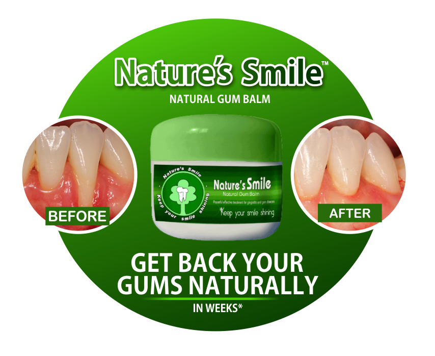 Nature’s Smile Review A Natural Solution to Receding Gums by Natures